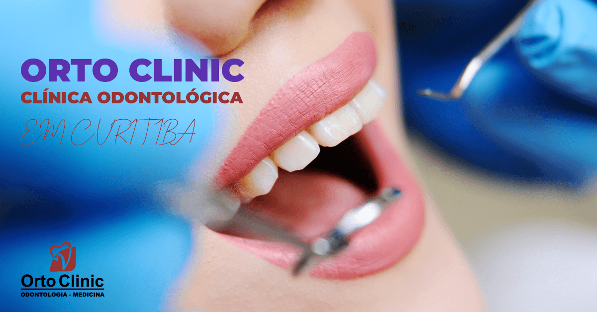 ortoclinic_odontologia_dentista_curitiba_ortopedista
